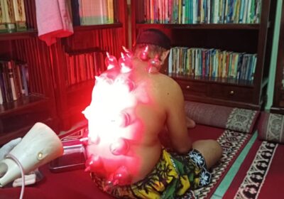 FAST-RESPON-WA-0811-9202-033-Tempat-Bekam-Laki-Laki-Menteng-Dalam-Tebet-2