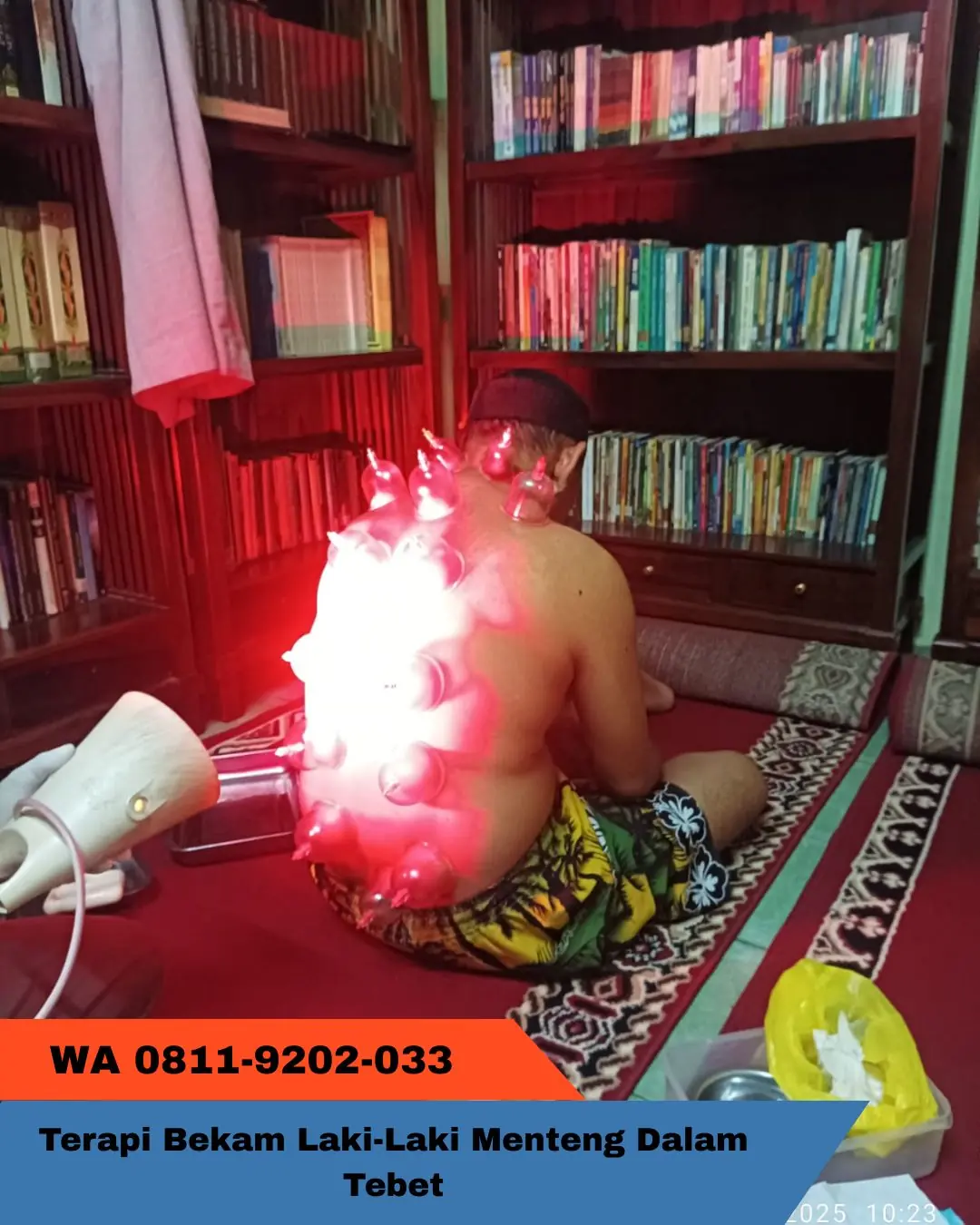 NYAMAN, Terapi Bekam Laki-Laki Menteng Dalam Tebet